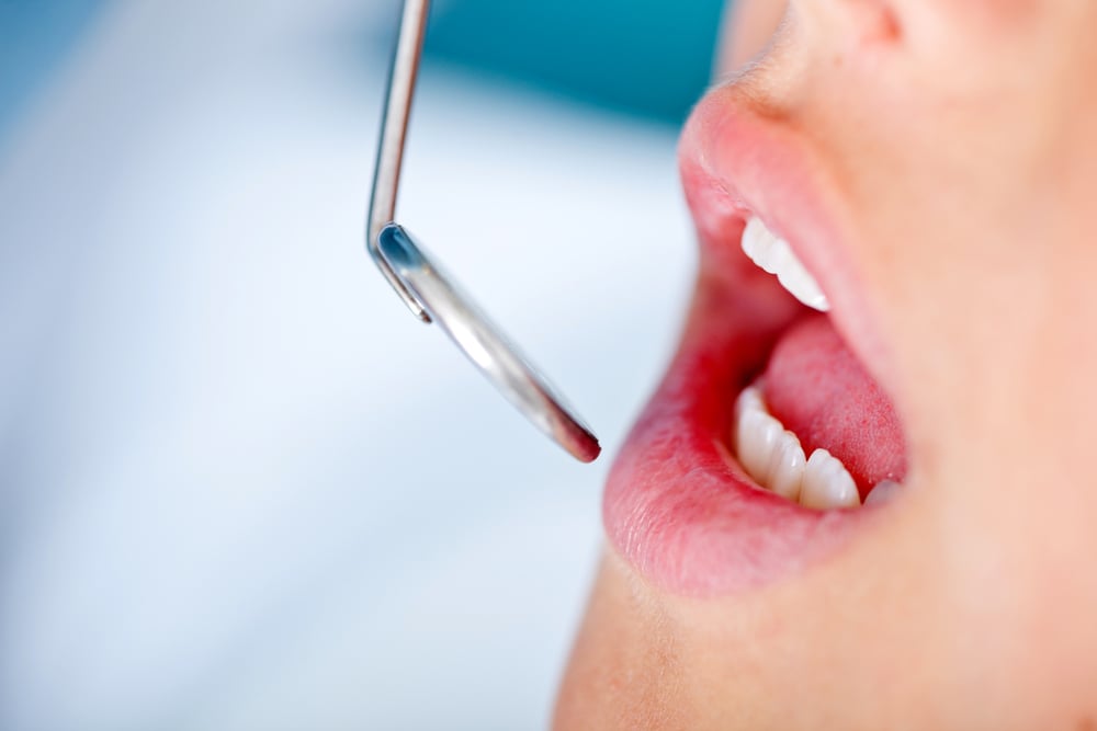 What Happens During a Dental Check-up?