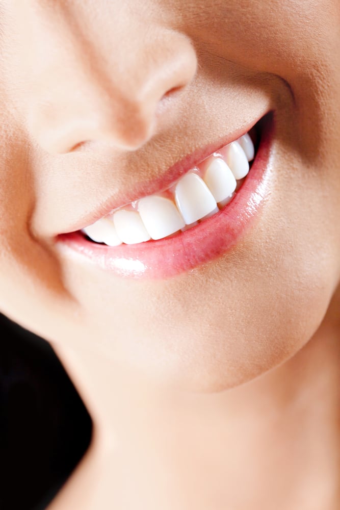 Boosting Your Smile Confidence with Smile Makeover