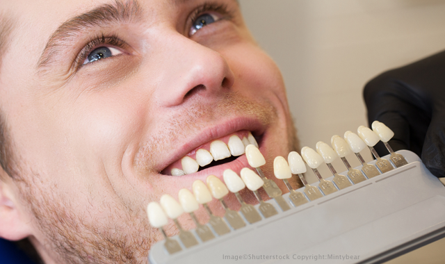 The Benefits of Dental Composite Bonding