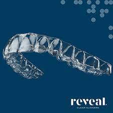 reveal aligners