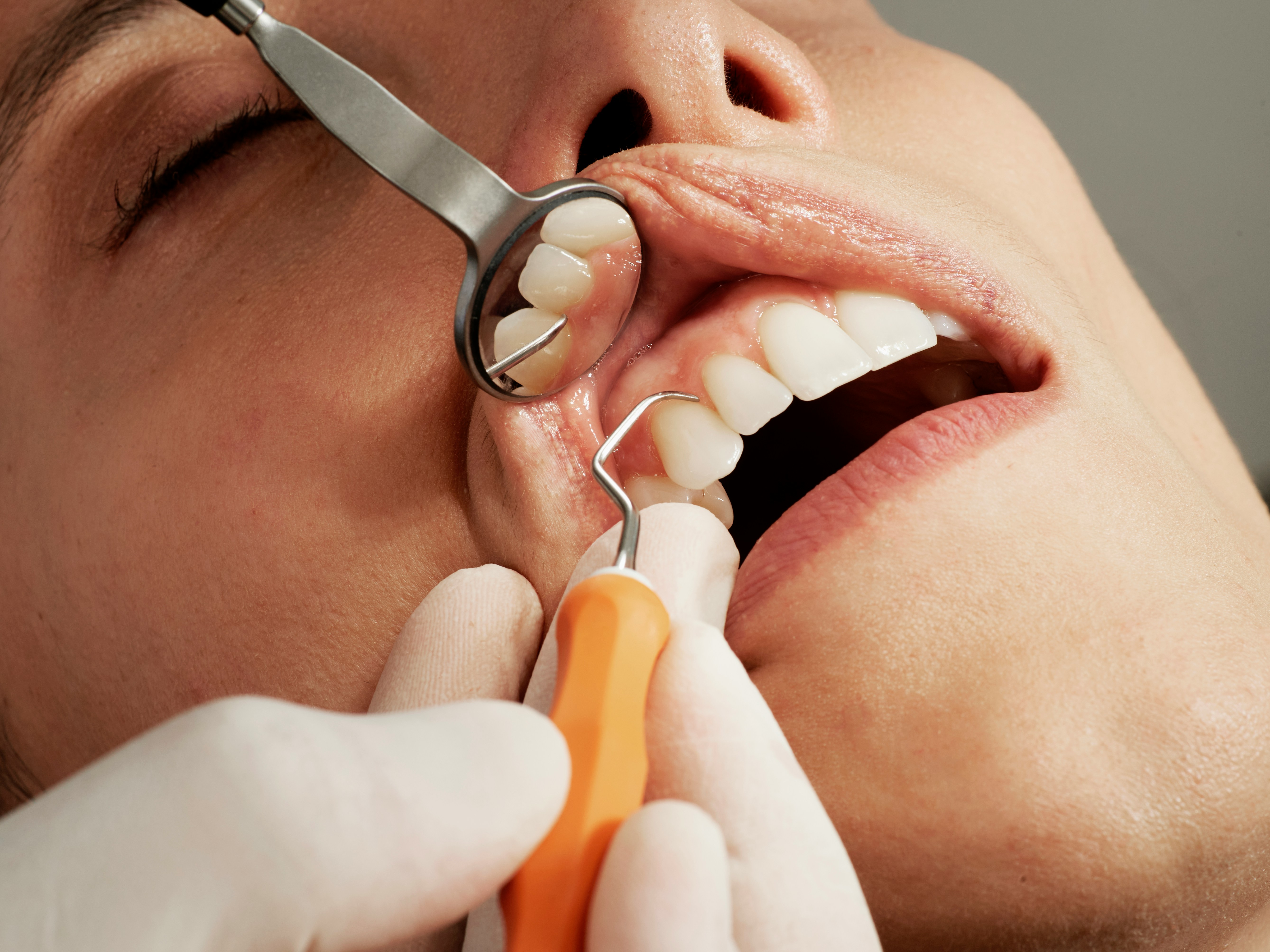 The Ultimate Dental Exam Checklist