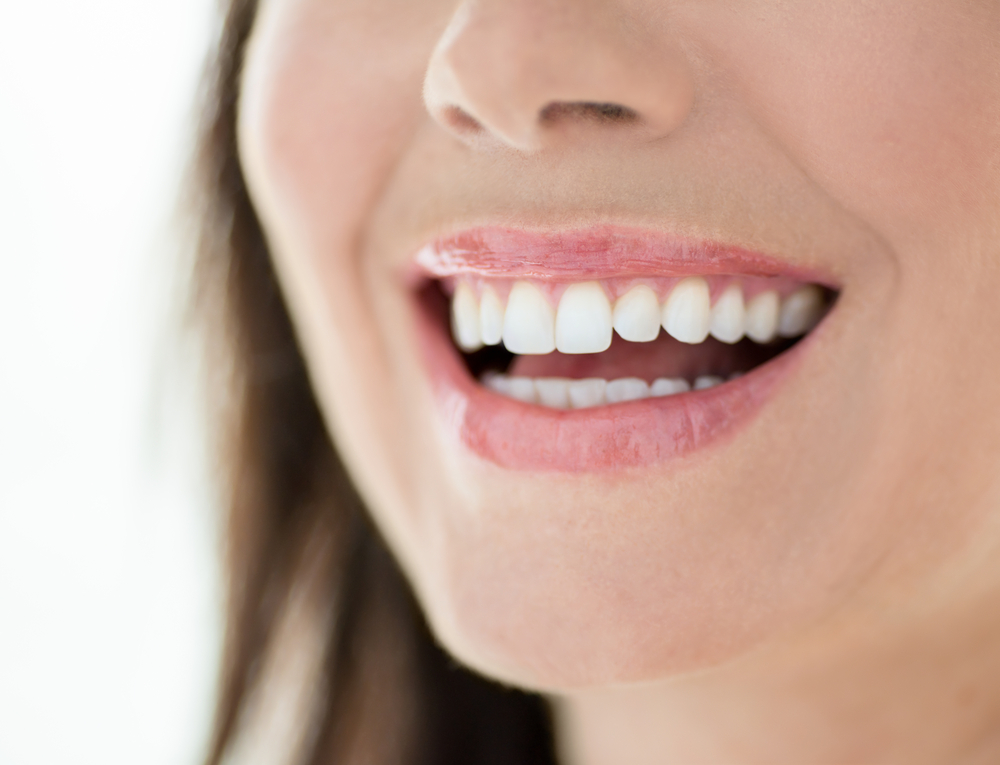 Transform Your Smile with Aligners and Composite Bonding