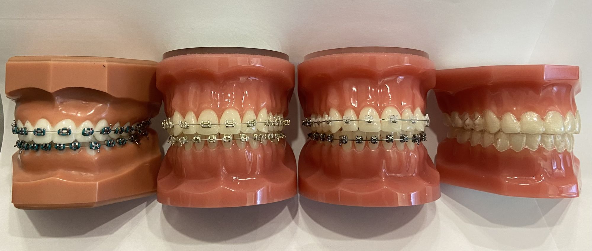 Types of Orthodontic Appliances: Which One is Right for You?